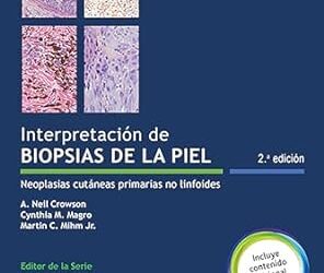 Interpretación de biopsias de la piel: Neoplasias cutáneas primarias no linfoides（西班牙文版）第二版