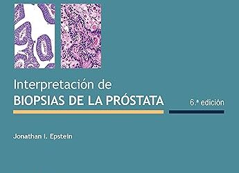 Interpretación de biopsias de la próstata (Spanish Edition) 1st Edition