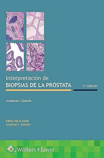 Interpretación de biopsias de la próstata（西班牙语版）第一版