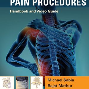 Interventional Pain Procedures Handbook and Video Guide 1st Edition