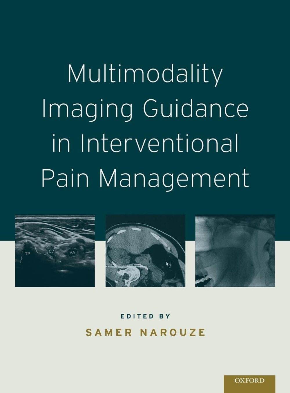 Orientação por imagem multimodal no tratamento intervencionista da dor 1ª edição