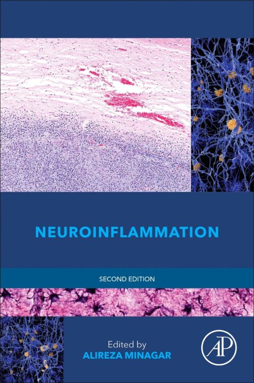 Neuroinflammation 2e édition