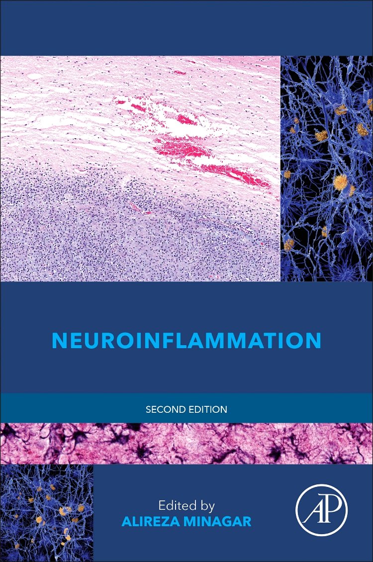 Neuroinflammation 2nd Edition
