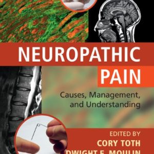 Neuropathic Pain Causes, Management and Understanding 1st Edition