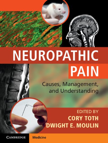 Причины нейропатической боли, лечение и понимание, 1-е издание