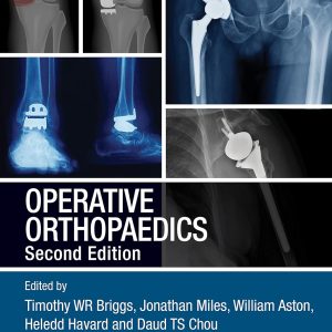 Operative Orthopaedics 2nd Edition