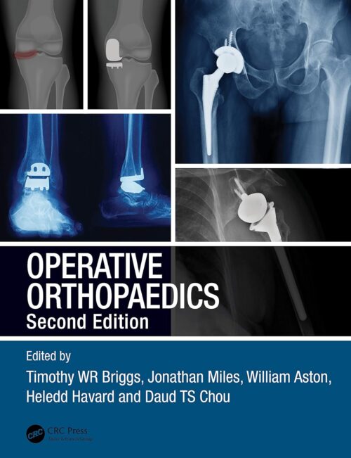Ortopedia Operatória 2ª Edição
