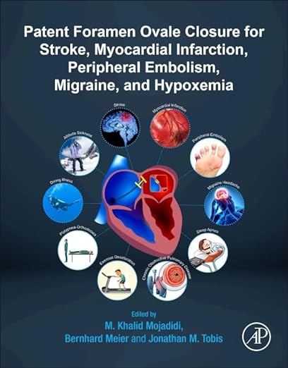 Patent Foramen Ovale Closure for Stroke, Myocardial Infarction, Peripheral Embolism, Migraine, and Hypoxemia 1st Edition