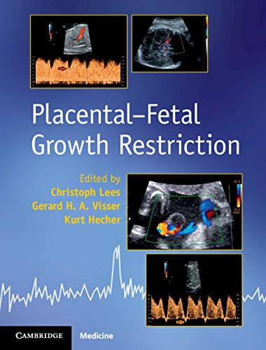Restricció del creixement placento-fetal 1a edició