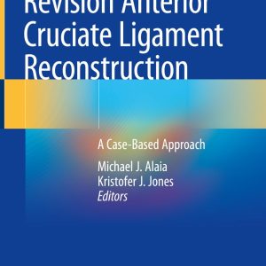 Revision Anterior Cruciate Ligament Reconstruction A Case-Based Approach 1st ed. 2022 Edition