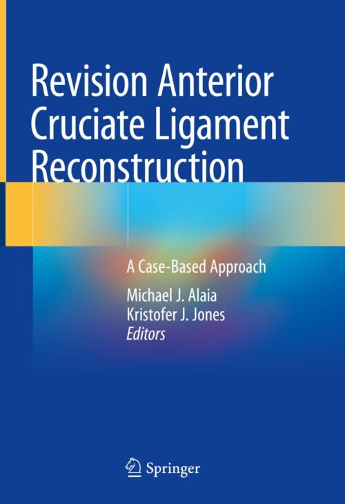 Revision Anterior Cruciate Ligament Reconstruction A Case-Based Approach 1st ed. 2022 Edition