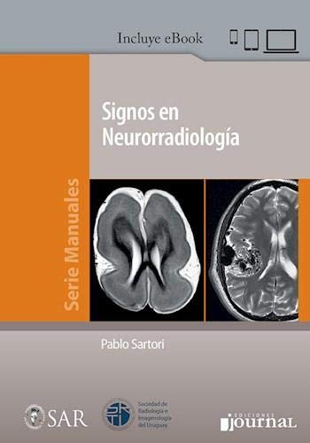 Znaki w neuroradiologii