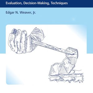 Surgical Care of the Painful Degenerative Lumbar Spine Evaluation, Decision-Making, Techniques 1st Edition