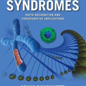 Syndromes Rapid Recognition and Perioperative Implications, 2nd edition