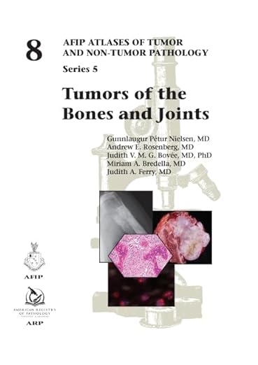 Tumores dos Ossos e Articulações (Atlas AFIP de Patologia Tumoral e Não Tumoral, Série 5, Volume 8)