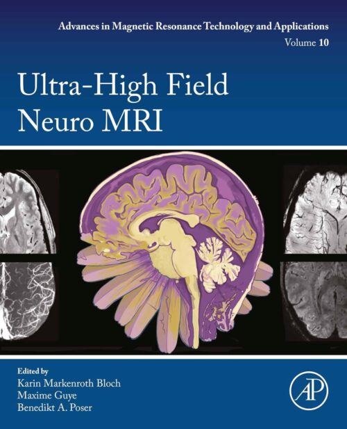 超高磁場神経MRI