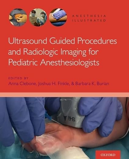 Procedimentos guiados por ultrassom e imagens radiológicas para anestesiologistas pediátricos (Anestesia ilustrada) Edição ilustrada