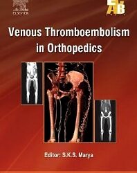 Venous Thromboembolism in Orthopedics