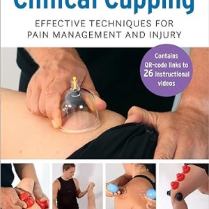 A Practitioner’s Guide to Clinical Cupping Effective Techniques for Pain Management and Injury
