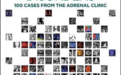 Adrenal Disorders: 100 Cases from the Adrenal Clinic (1st ed/1e) First Edition