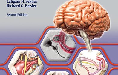 Atlas of Neurosurgical Techniques: Brain Second Edition (2nd ed/2e)