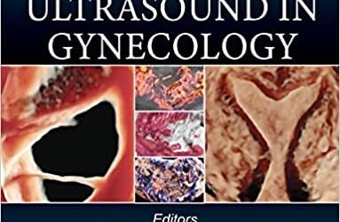 Donald School 3D-4D Ultrasound in Gynecology (1st Ed/1e) First Edition