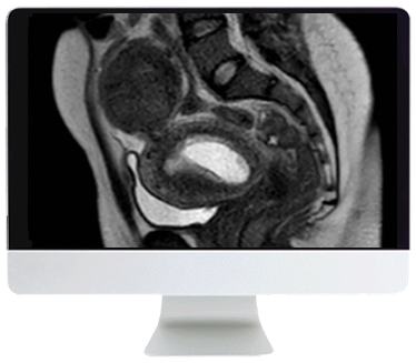 ARRS Abdominal MRI: Practical Applications and Advanced Imaging Techniques 2021 (CME VIDEOS)