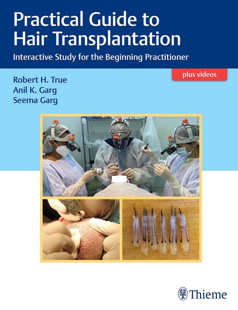 Practical Guide to Hair Transplantantion: Interactive study for the Beginning Practitioner
