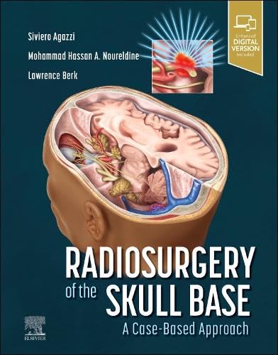 Radiocirurgia da Base do Crânio Uma Abordagem Baseada em Casos 1ª Edição