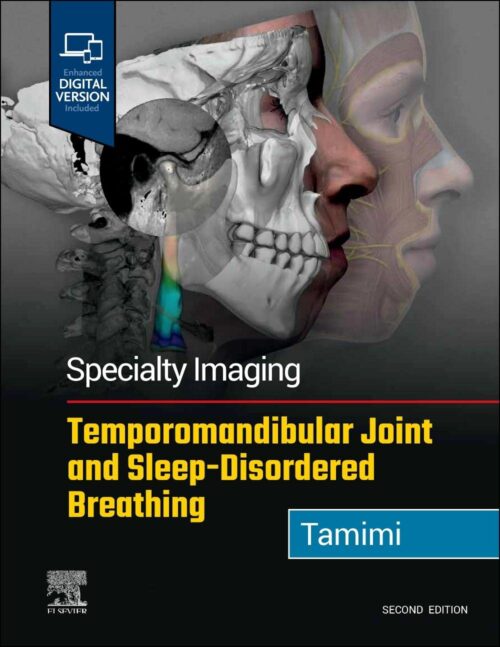 Imagem Especializada Articulação Temporomandibular e Distúrbios Respiratórios do Sono 2ª Edição