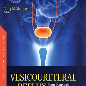 Vesicoureteral Reflux From Diagnosis to Treatment