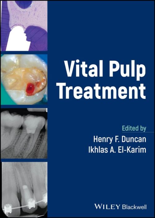 Vital Pulp Treatment 1st Edition