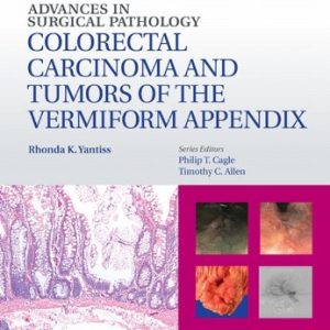 Advances in Surgical Pathology: Colorectal Carcinoma and Tumors of the Vermiform Appendix 1st Edition