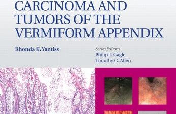 Advances in Surgical Pathology: Colorectal Carcinoma and Tumors of the Vermiform Appendix 1st Edition