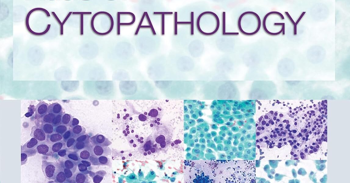 Atlas of Cytopathology: A Pattern Based Approach 1st Edition