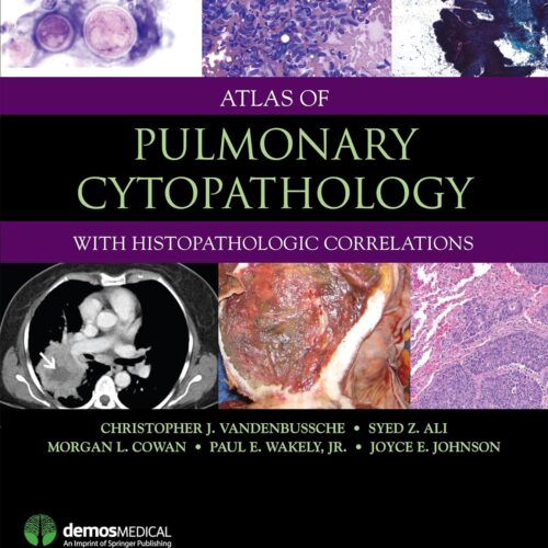 Atlas of Pulmonary Cytopathology 1st Edition