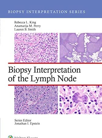 Biopsy Interpretation of the Lymph Node First Edition