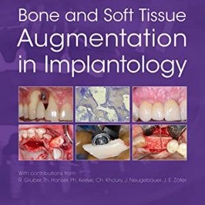 Bone and Soft Tissue Augmentation in Implantology 1st Edition