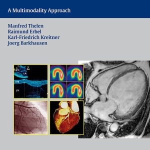 Cardiac Imaging  A Multimodality Approach