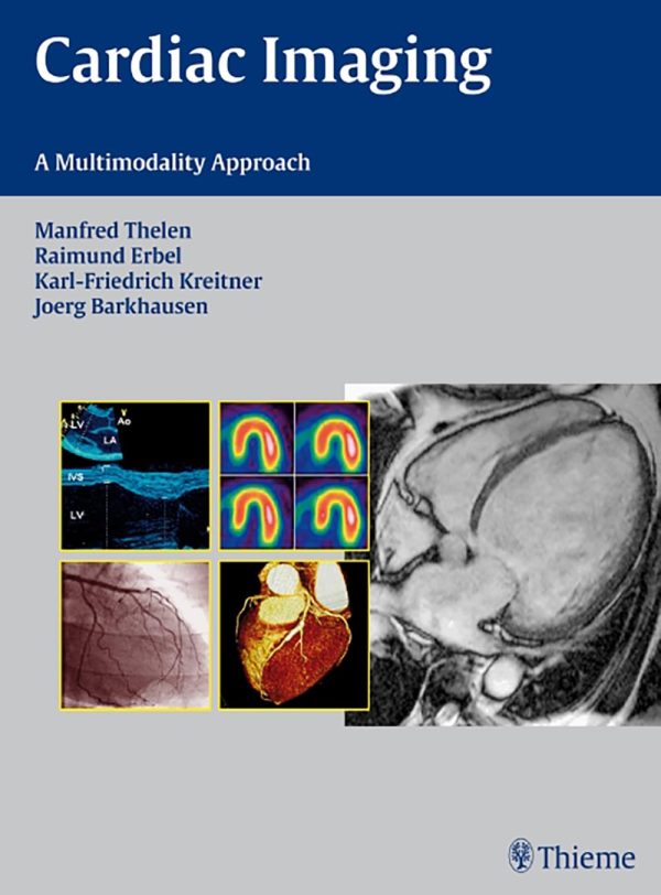 Cardiac Imaging  A Multimodality Approach