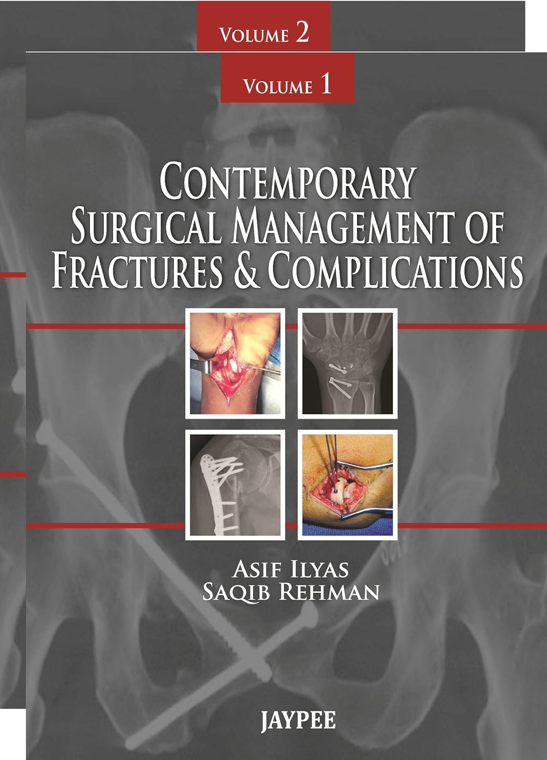Contemporary Surgical Management of Fractures and Complications 1st Edition