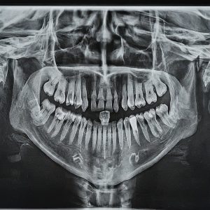 Dental, Oral-Maxillofacial Surgery