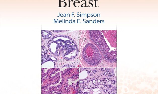 Differential Diagnoses in Surgical Pathology Breast