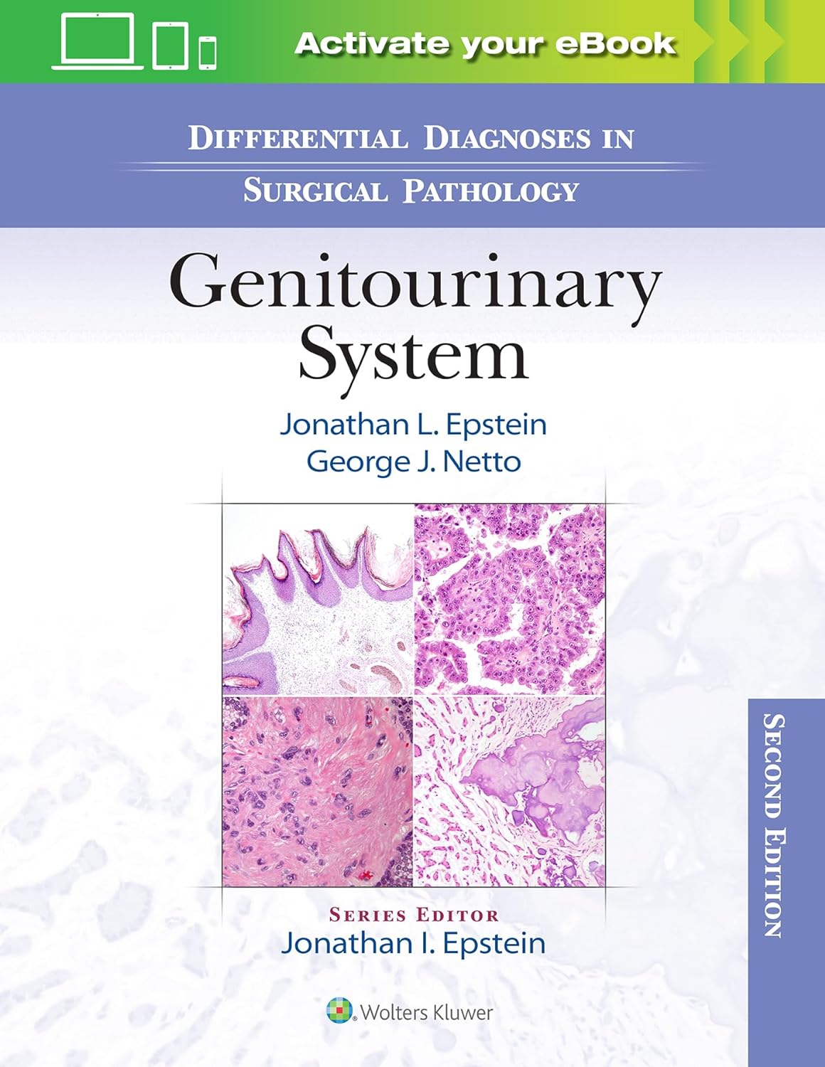 Differential Diagnoses in Surgical Pathology Genitourinary System 2nd Edition