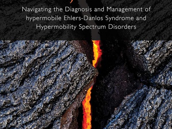 Diagnosis and Management of Hypermobile Ehlers-Danlos Syndrome and Hypermobility Spectrum Disorders
