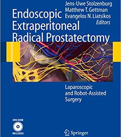 Endoscopic Extraperitoneal Radical Prostatectomy: Laparoscopic and Robot-Assisted Surgery 2007th Edition