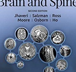 ExpertDDx: Brain and Spine 2nd Edition (EXPERT DDX 2e second ed)