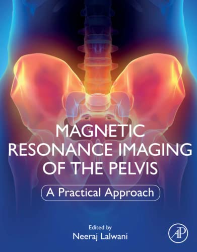 Magnetic Resonance Imaging (MRI) of The Pelvis: A Practical Approach 1st Edition