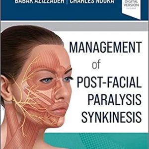 Management of Post-Facial Paralysis Synkinesis 1st Edition