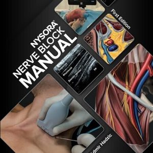NYSORA Nerve Block Manual First Edition